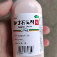 炉甘石洗剂